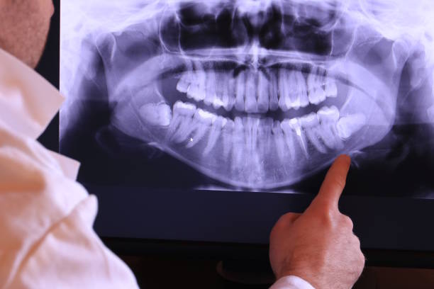 Best Walk-In Emergency Dentist in Rshfield Hills, MA
