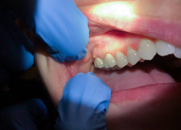  Rshfield Hills, MA Emergency Dentist Pros