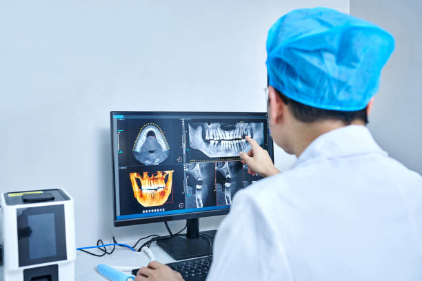 Best Emergency Wisdom Teeth Removal in Rshfield Hills, MA