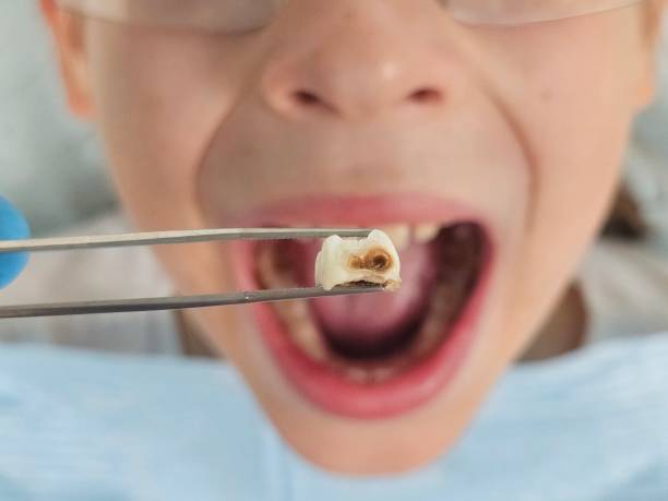 Best Walk-In Emergency Dentist in Rshfield Hills, MA